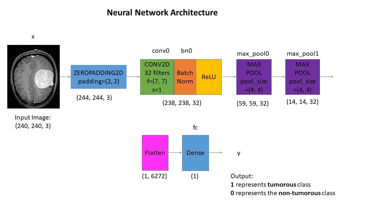 Brain Tumor Detection